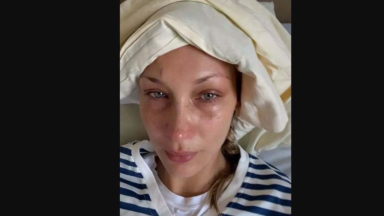 Bella Hadid’den endişelendiren paylaşım: Hastane yatağından fotoğraflar