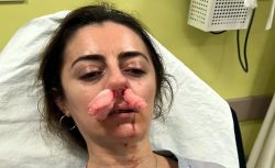 Eşinin sevgilisi sandığı kadına saldırdı: 4 yıl 6 aya kadar hapsi istendi
