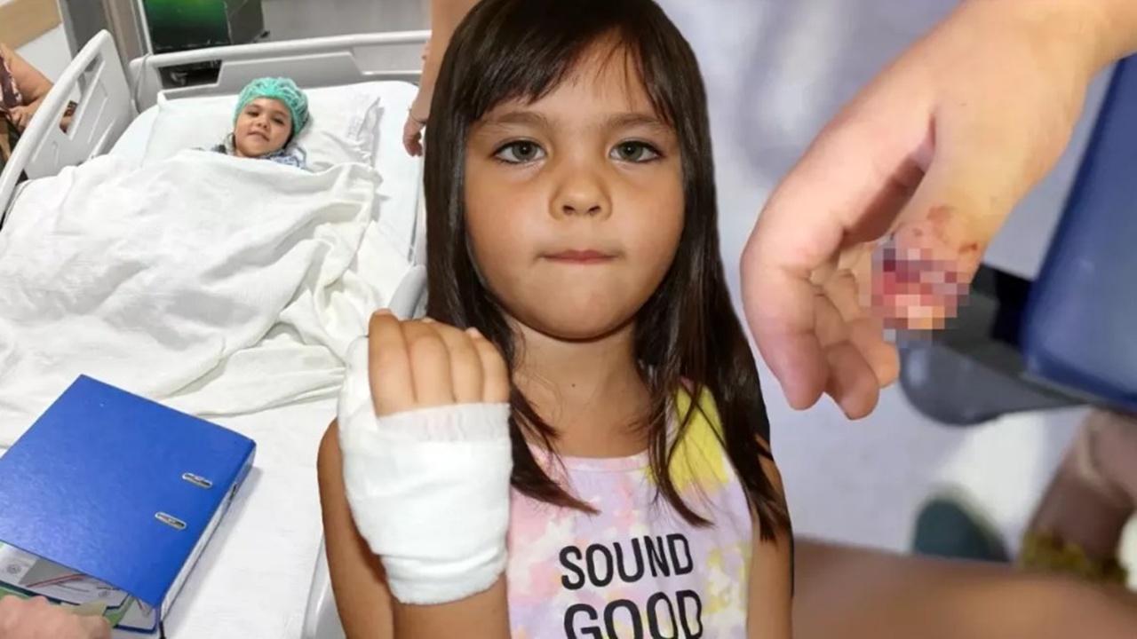 Anaokulunda korkunç ihmal! 4 yaşındaki Mavi’nin parmağı demir kapıya sıkışıp koptu